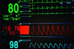 This image shows a healthy 98% oxygen saturation level (www.shutterstock.com.) 